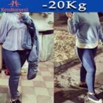 Dimagrimento Metodo KetoNatural -20Kg